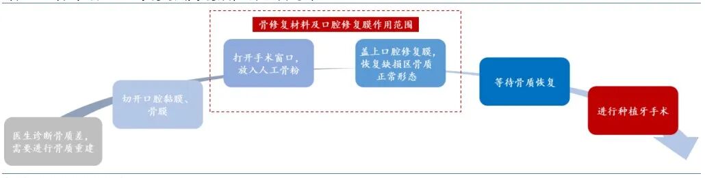 什么是口腔修复膜齐声众口NO.22 ｜ 口腔修复材料：借种植牙集采东风，迎国产替代“超车”良机_https://www.jmylbn.com_新闻资讯_第4张