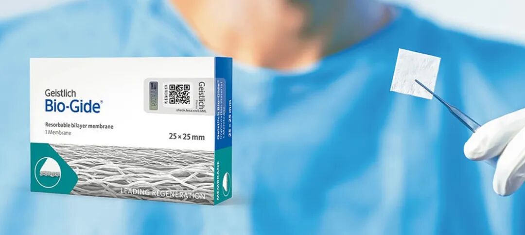 什么是口腔修复膜齐声众口NO.22 ｜ 口腔修复材料：借种植牙集采东风，迎国产替代“超车”良机_https://www.jmylbn.com_新闻资讯_第8张