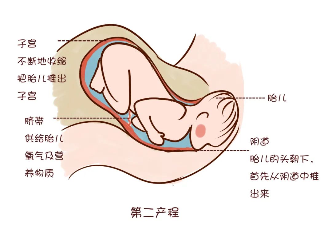 胎儿分娩 物流图片