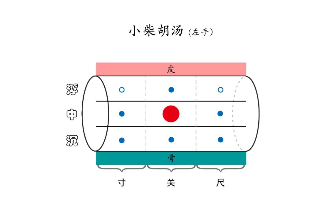 千古名方小柴胡汤使用的秘密，原来是…