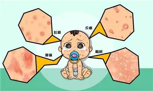 小兒濕疹（atopic dermatitis，AD） 健康 第2張