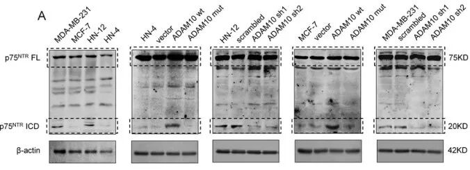 RayBiotech抗体芯片在肿瘤转移及耐药机制研究的应用(图8)