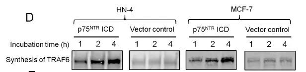 RayBiotech抗体芯片在肿瘤转移及耐药机制研究的应用(图15)