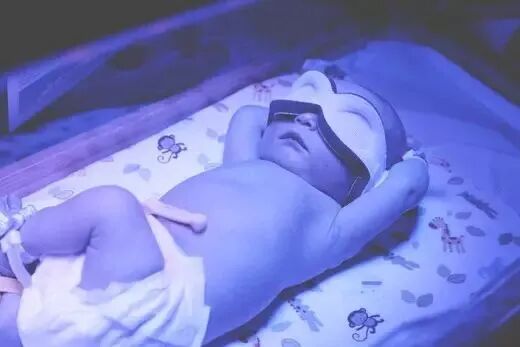 光疗时为什么黑眼罩孩子皮肤黑，跟出生时照蓝光有关系吗？_https://www.jmylbn.com_新闻资讯_第4张