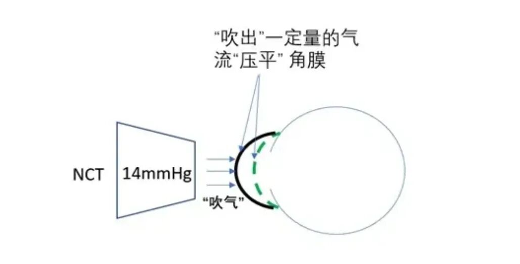 goldmann眼压计怎么读中央角膜厚度(CCT)对于眼内压的影响_https://www.jmylbn.com_新闻资讯_第2张