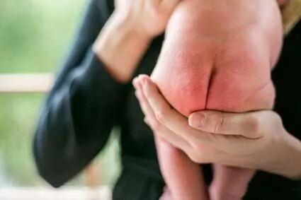 怪不得宝宝总是红屁屁，原来是这里出了问题！