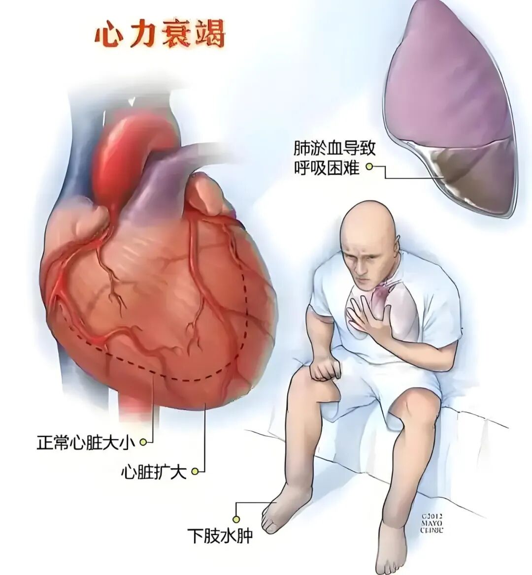 BE药片治什么作用一片小药片，降血糖、改善心力衰竭、护肾脏，一药三效，一文了解_https://www.jmylbn.com_新闻资讯_第2张
