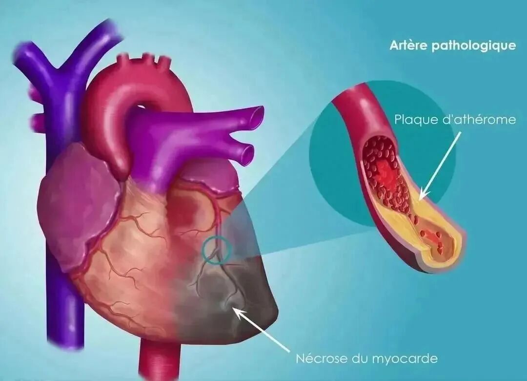 5药活血化瘀、通络止痛，改善微循环，抗动脉硬化，保护心脑血管