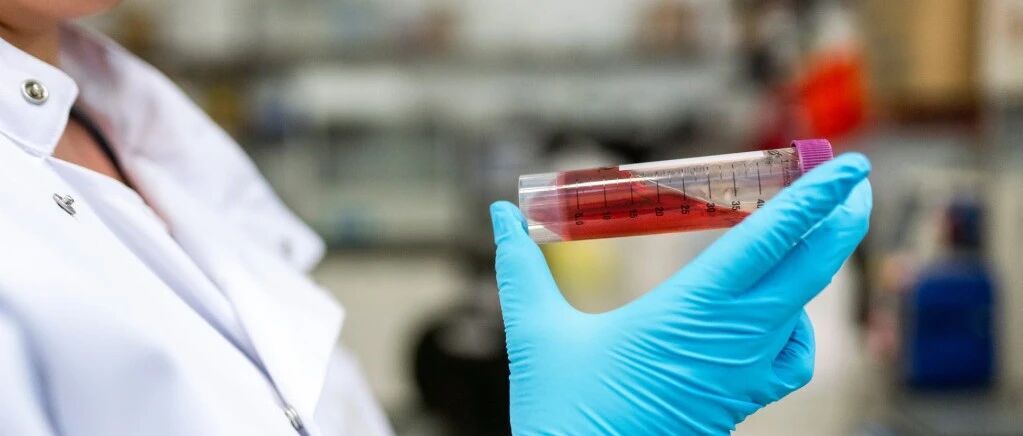 什么血型得什么病！最健康的血型居然是…第一次听说，长知识了~