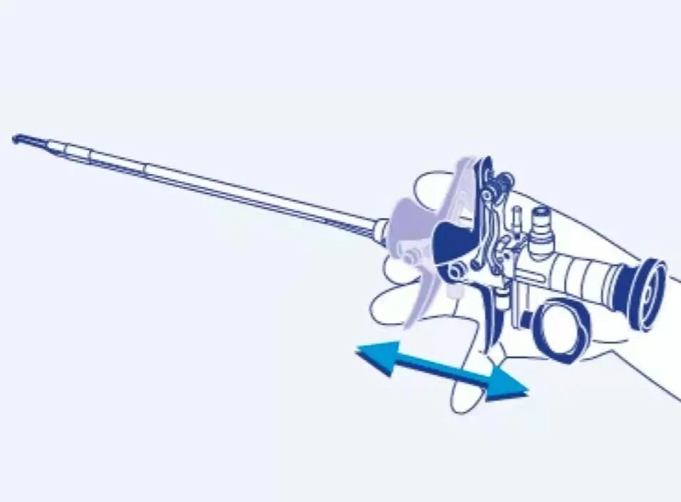 宫腔镜器械怎么组装手术器械介绍——宫腔镜组成与安装、种类与作用详解_https://www.jmylbn.com_新闻资讯_第10张