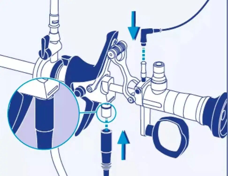宫腔镜器械怎么组装手术器械介绍——宫腔镜组成与安装、种类与作用详解_https://www.jmylbn.com_新闻资讯_第13张