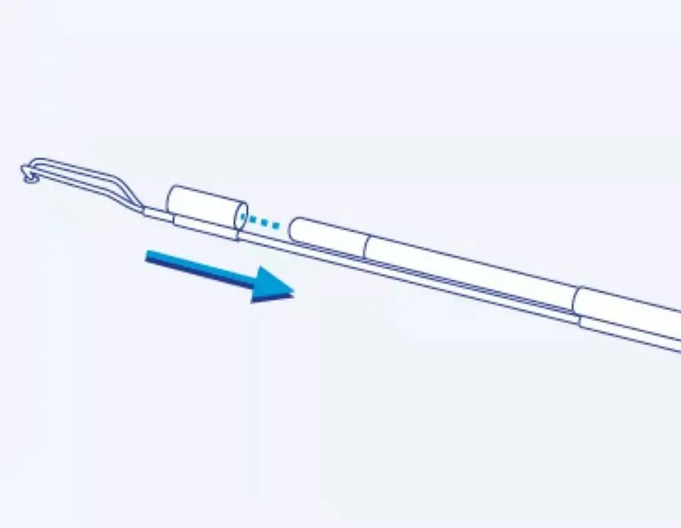 宫腔镜器械怎么组装手术器械介绍——宫腔镜组成与安装、种类与作用详解_https://www.jmylbn.com_新闻资讯_第9张
