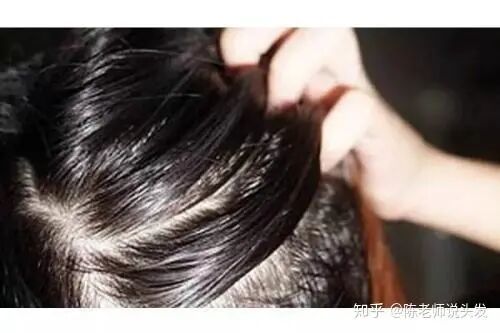 夏季护发问题怎么解决？