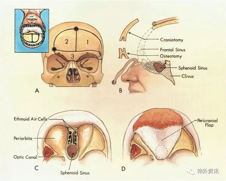 图1-5(含篇首),来自rhoton教授《the foramen magnum》