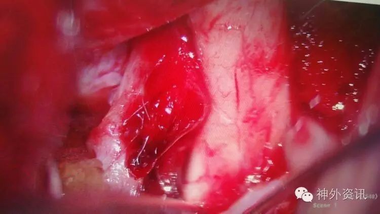 男性睾丸红色血管图片图片