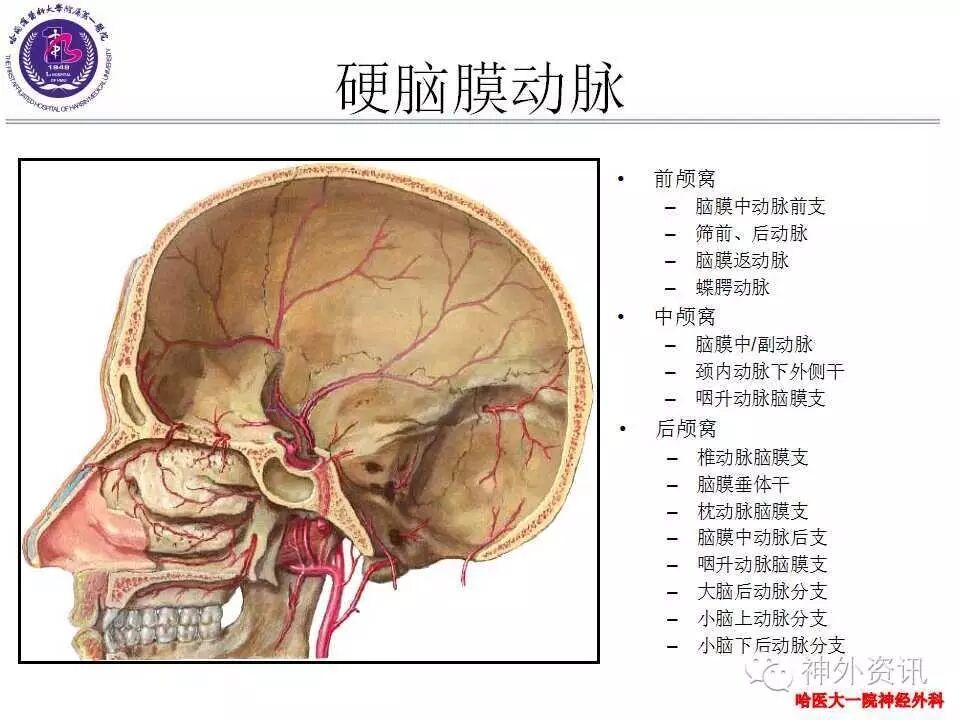 天新福神经介入专栏史怀璋教授硬脑膜动静脉瘘的治疗策略