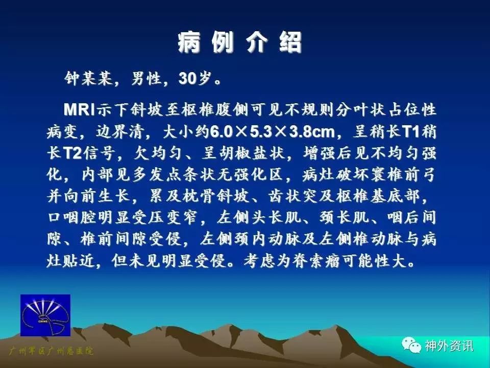 王国良教授颅颈交界处腹侧脊索瘤的手术治疗策略