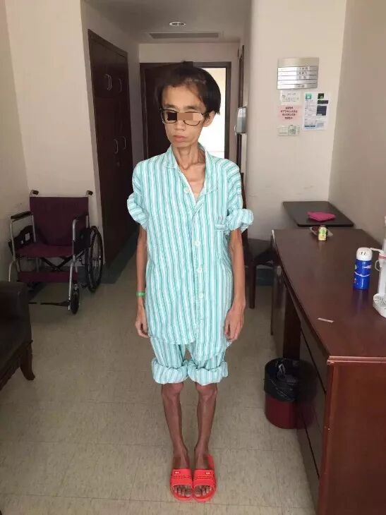 【景昱-神经科学专栏】| dbs治疗厌食症的围手术期注意事项