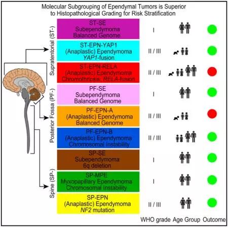 of key molecular and clinical characteristics of ependymal