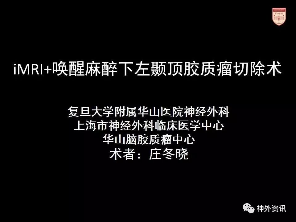 庄冬晓教授imri唤醒麻醉下左颞顶胶质瘤切除术