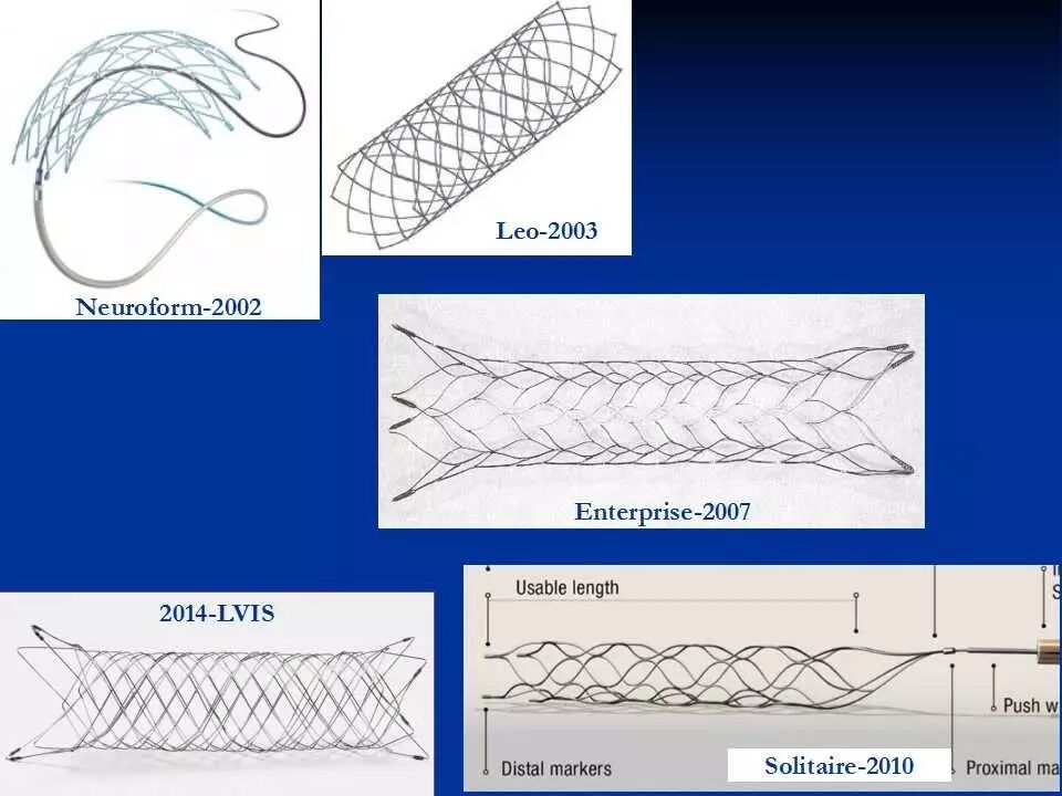 管生教授:enterprise支架临床应用现状 - 脑医汇 - 神外资讯 - 神介
