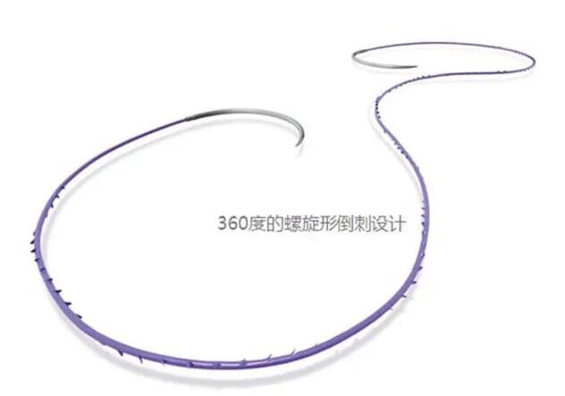 倒刺线怎么缝合TA的名字：倒刺线_https://www.jmylbn.com_新闻资讯_第4张