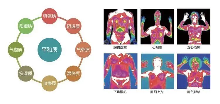 中医经络检测哪些中医经络仪，让您用中医的方式了解自己的身体状况！_https://www.jmylbn.com_新闻资讯_第12张