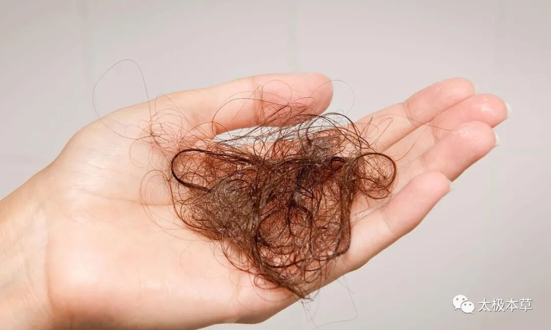 掉头发原因有气血不足、肾精亏虚、头发油多，都有不同的应对措施