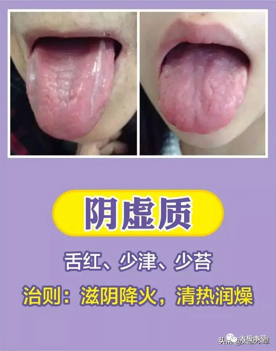 家备血糖仪有什么好处日常监测身体情况，家中常备这五种“神器””_https://www.jmylbn.com_新闻资讯_第14张