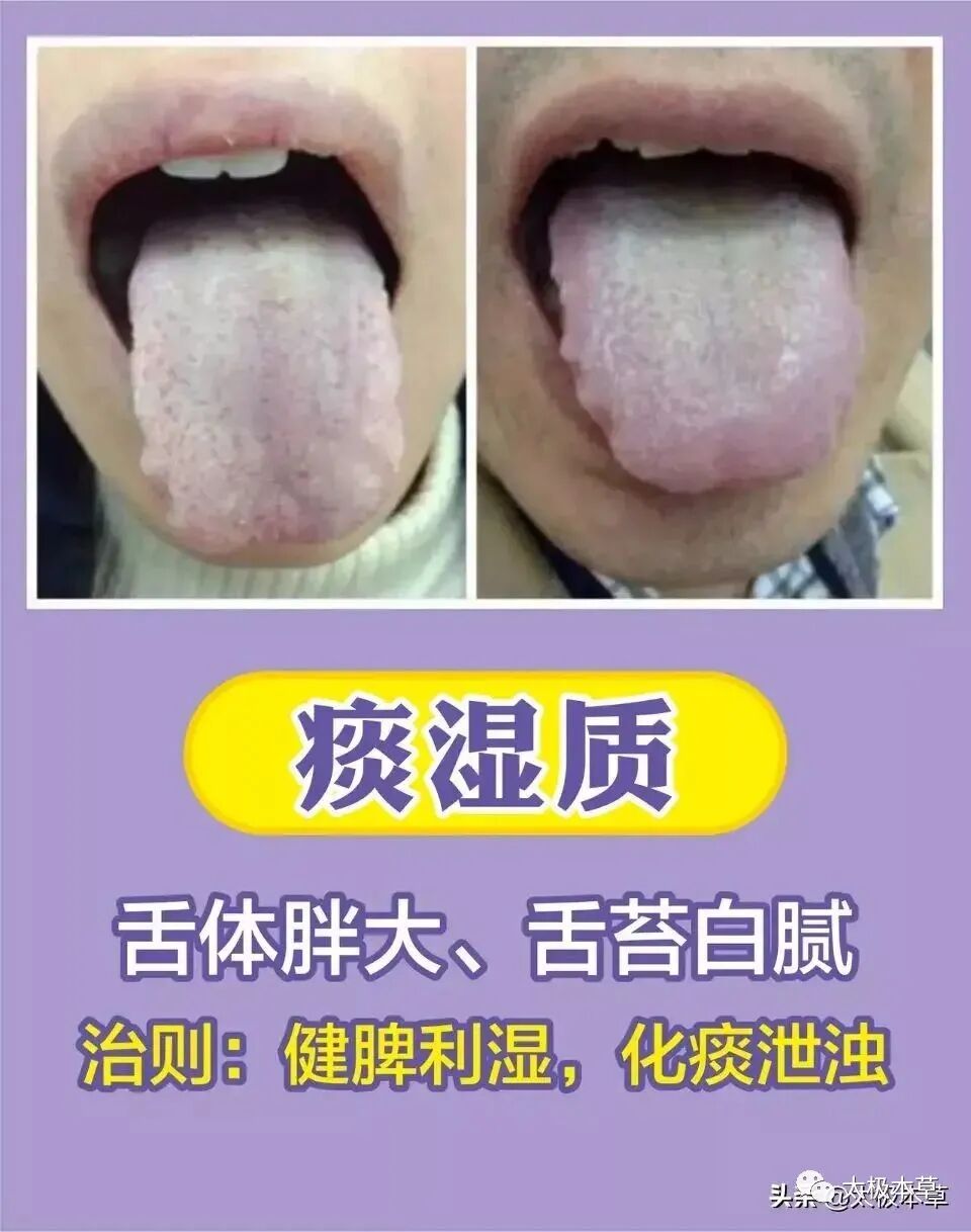 家备血糖仪有什么好处日常监测身体情况，家中常备这五种“神器””_https://www.jmylbn.com_新闻资讯_第17张