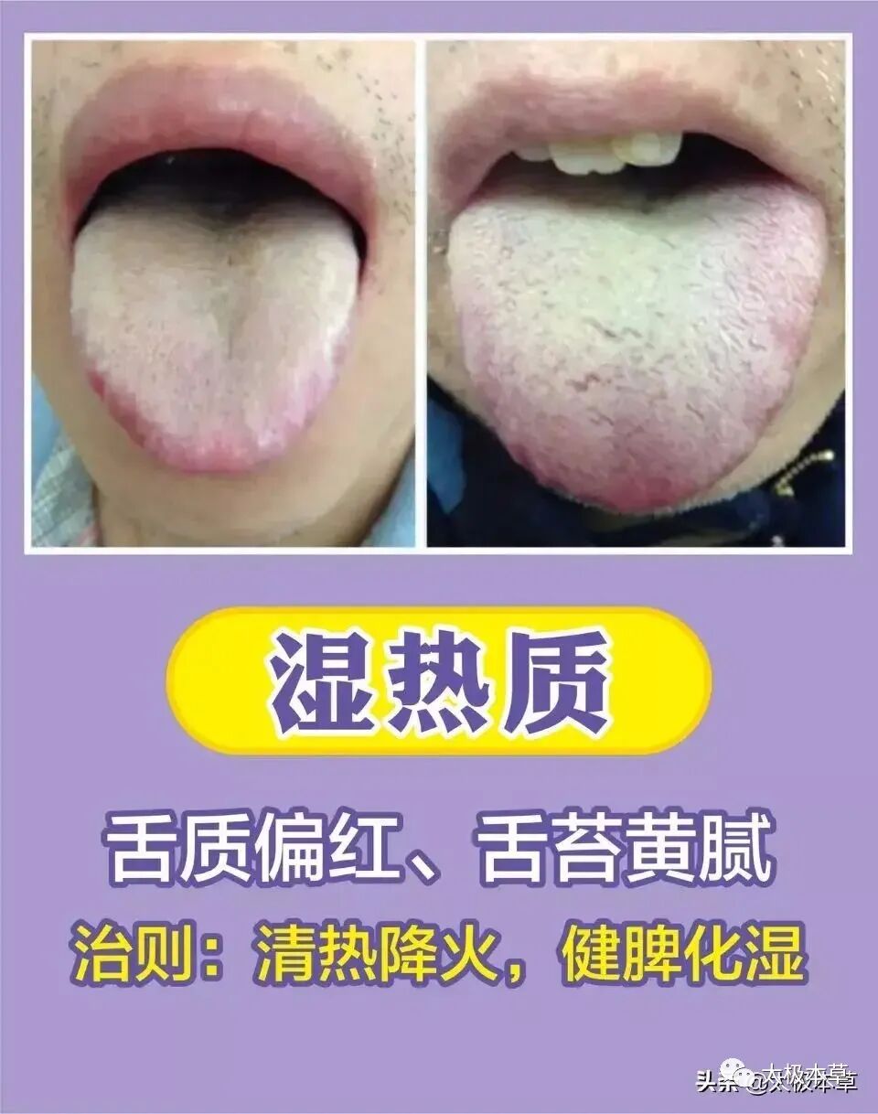 家备血糖仪有什么好处日常监测身体情况，家中常备这五种“神器””_https://www.jmylbn.com_新闻资讯_第22张