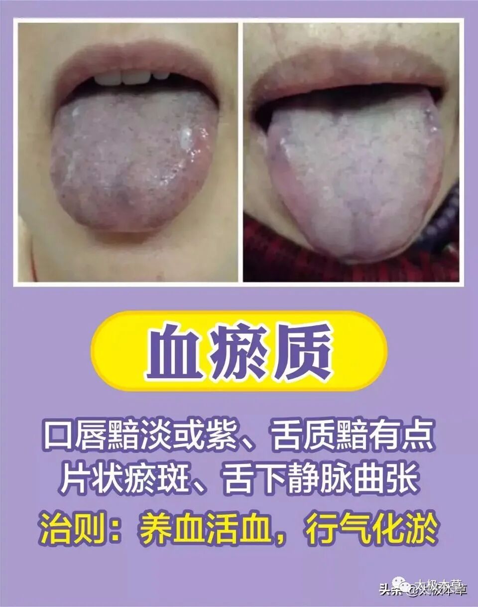 家备血糖仪有什么好处日常监测身体情况，家中常备这五种“神器””_https://www.jmylbn.com_新闻资讯_第11张