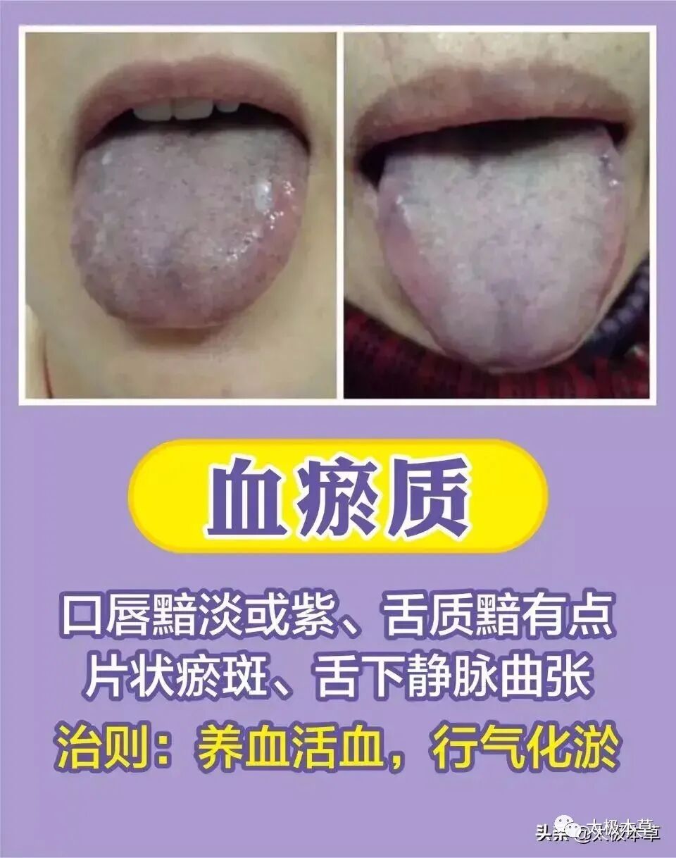 家备血糖仪有什么好处日常监测身体情况，家中常备这五种“神器””_https://www.jmylbn.com_新闻资讯_第12张