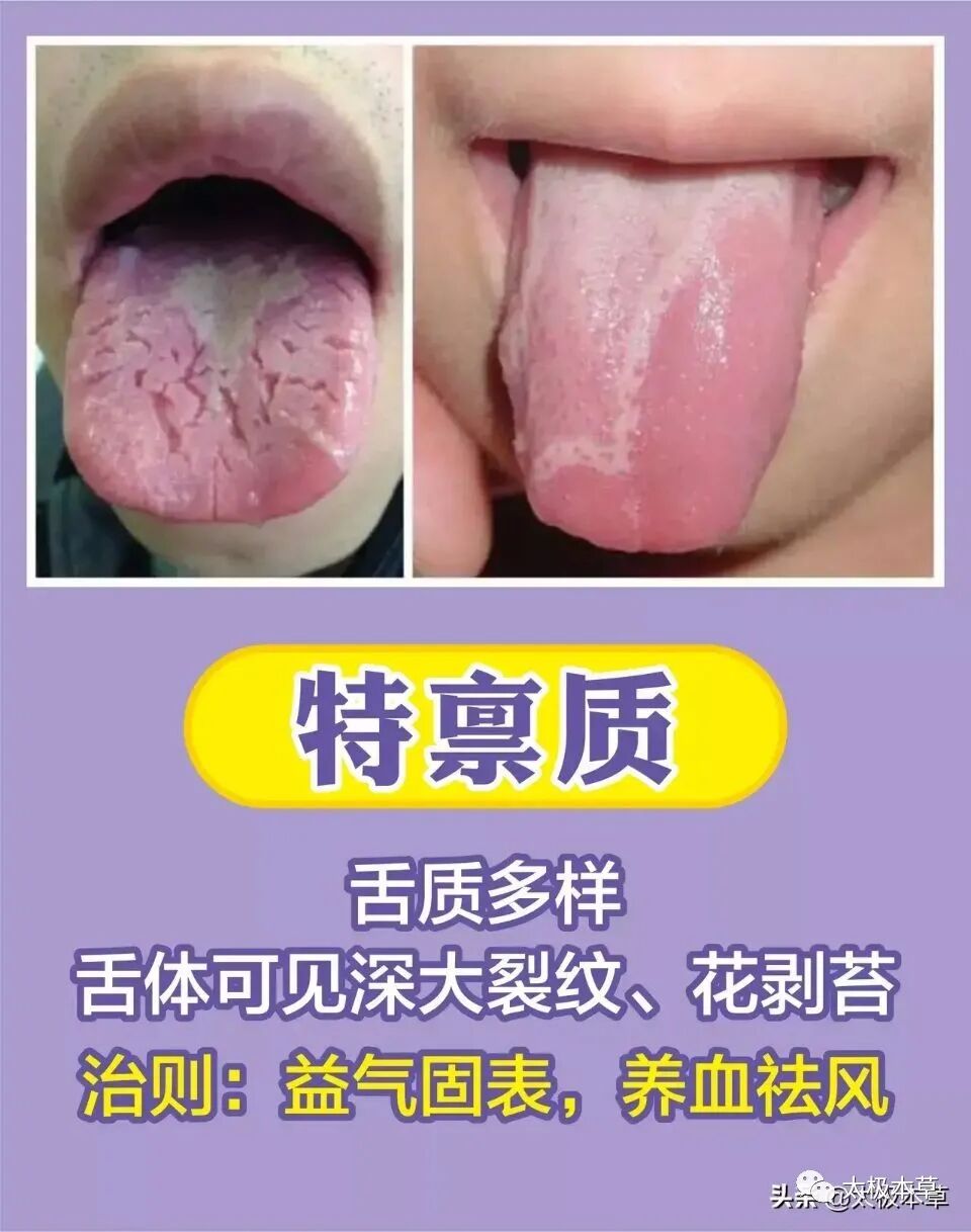 家备血糖仪有什么好处日常监测身体情况，家中常备这五种“神器””_https://www.jmylbn.com_新闻资讯_第18张