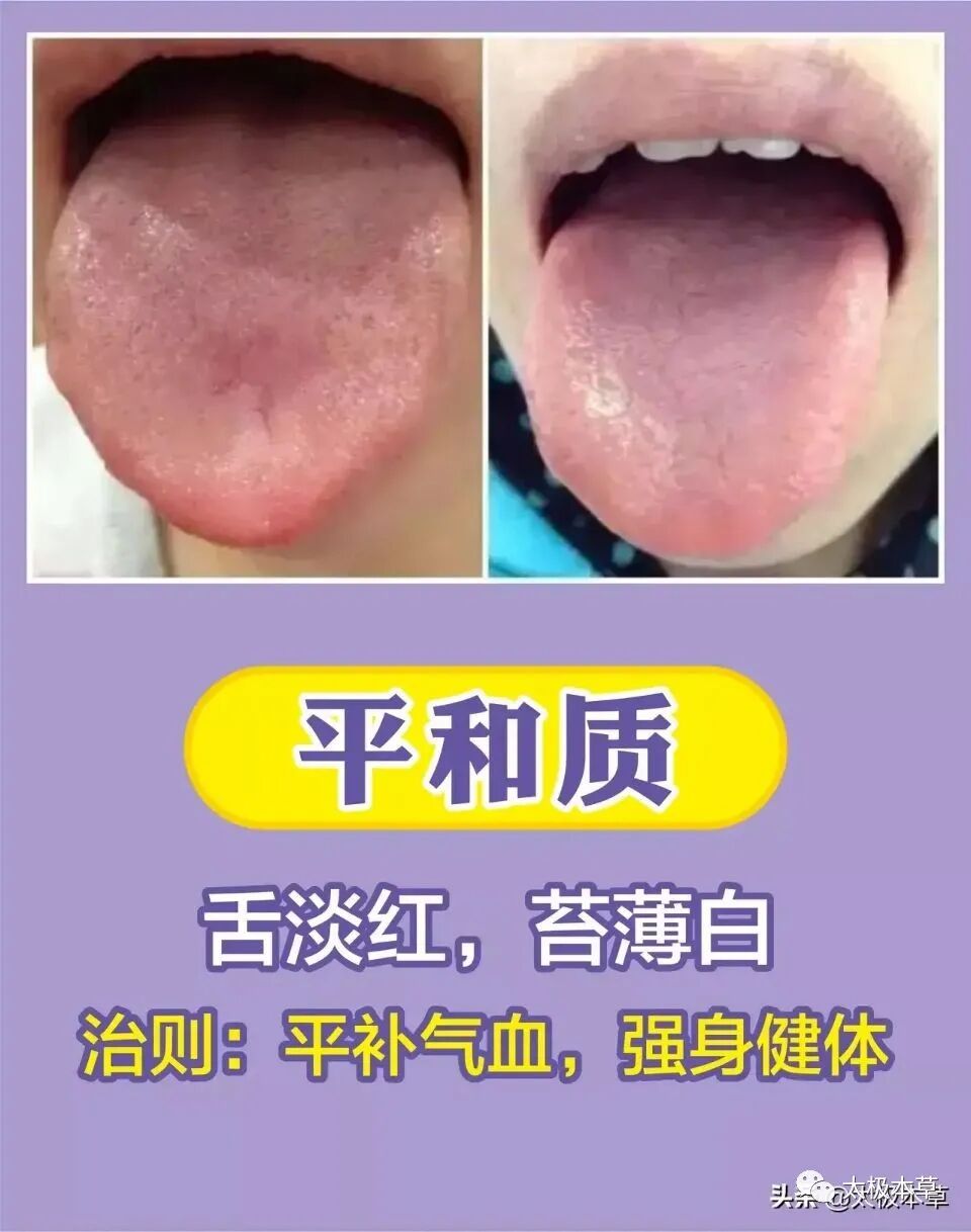 家备血糖仪有什么好处日常监测身体情况，家中常备这五种“神器””_https://www.jmylbn.com_新闻资讯_第13张