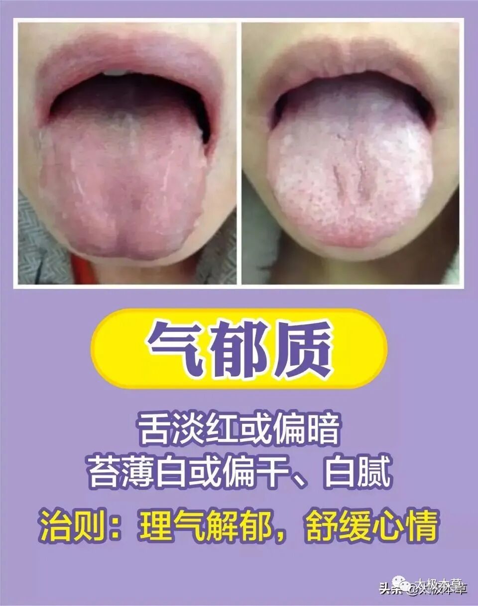 家备血糖仪有什么好处日常监测身体情况，家中常备这五种“神器””_https://www.jmylbn.com_新闻资讯_第21张