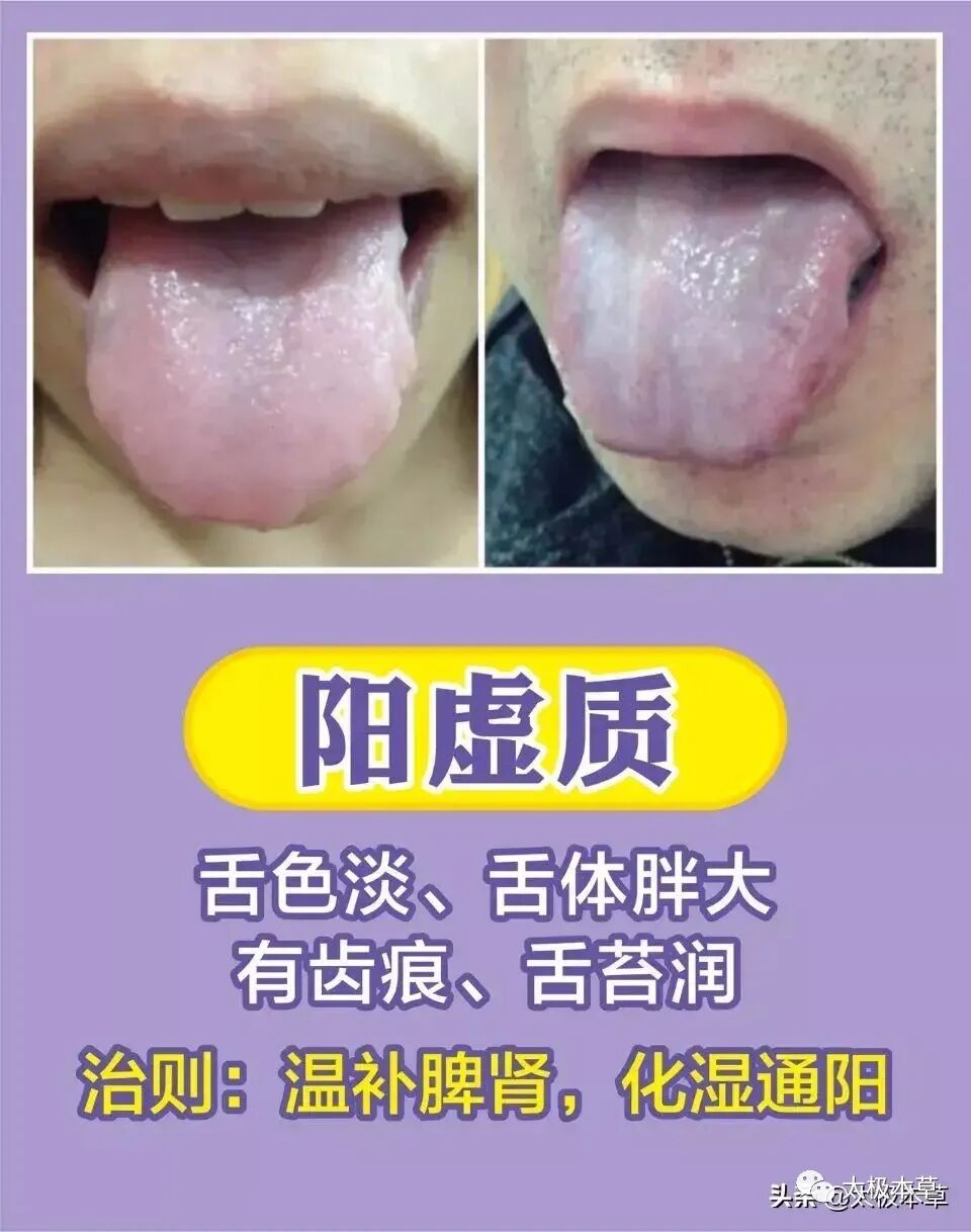 家备血糖仪有什么好处日常监测身体情况，家中常备这五种“神器””_https://www.jmylbn.com_新闻资讯_第19张