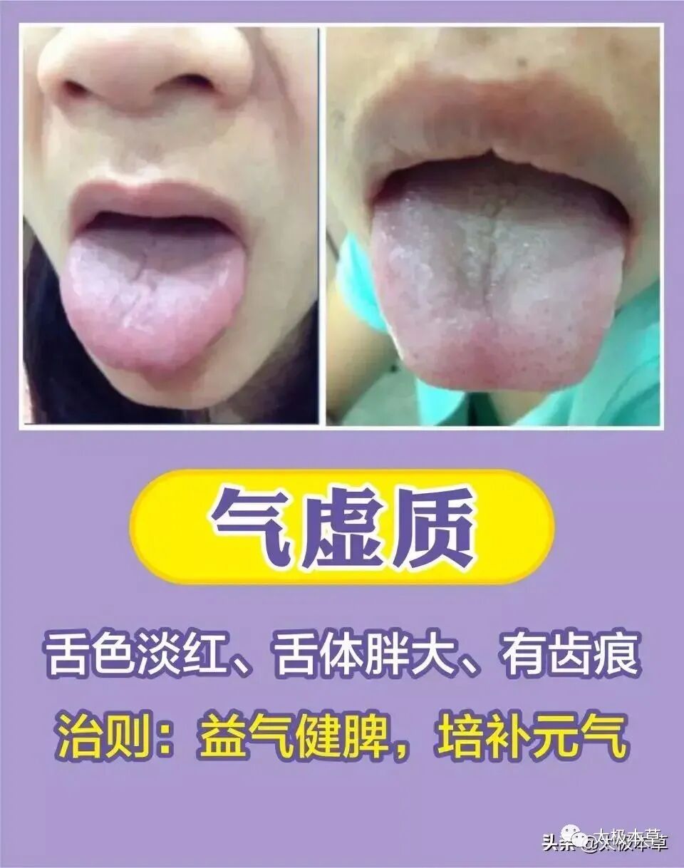 家备血糖仪有什么好处日常监测身体情况，家中常备这五种“神器””_https://www.jmylbn.com_新闻资讯_第20张