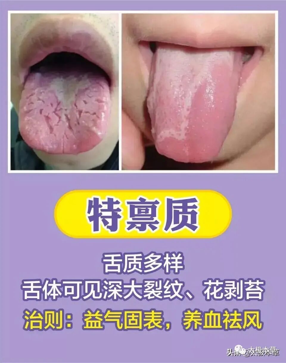 家备血糖仪有什么好处日常监测身体情况，家中常备这五种“神器””_https://www.jmylbn.com_新闻资讯_第15张