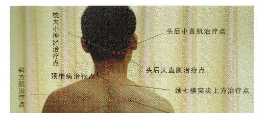 颈肩腰腿痛，用这招，立竿见影！