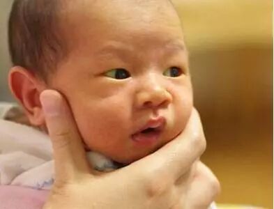 为什么大部分新生宝宝都会患上黄疸症，要紧吗？