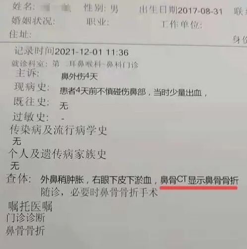 沈阳4岁小孩在早教中心摔成鼻骨骨折 后续赔偿起争议 热点讯息网