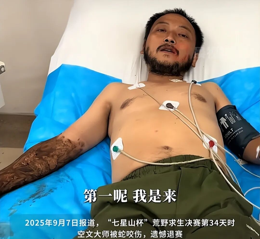 为10万奖金荒野求生70天你愿意吗