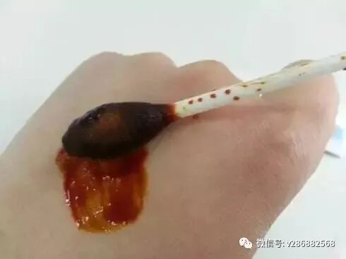 医用皮肤消毒液怎么用健康篇：碘伏一天最多能用几次_https://www.jmylbn.com_新闻资讯_第3张