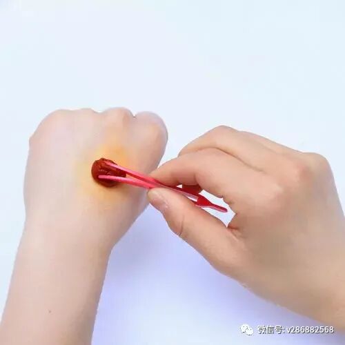 医用皮肤消毒液怎么用健康篇：碘伏一天最多能用几次_https://www.jmylbn.com_新闻资讯_第2张