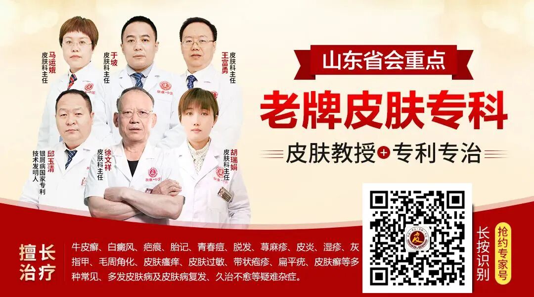 银屑病患者吃什么能提高免疫力-山东哪里看银屑病好-济南治疗银屑病最好的医院山东省段店看皮肤病-济南肤康皮肤病研究所「预约挂号」