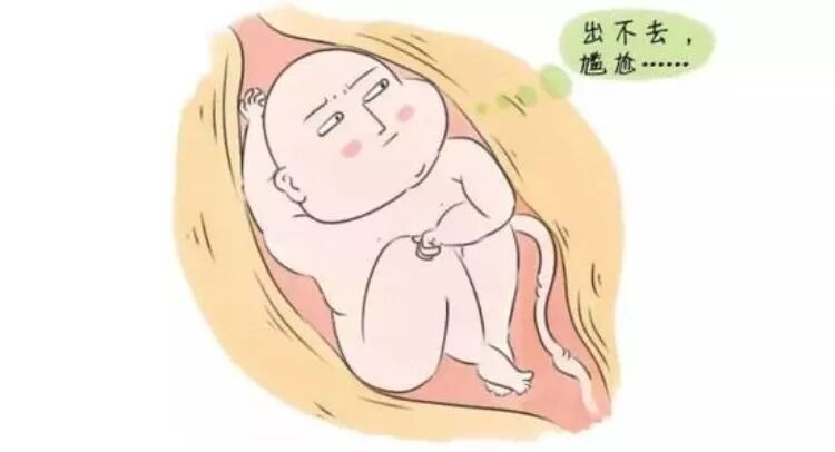 正常大小的胎儿都是通过母体的骨盆娩出的,但由于巨大儿的胎头大而硬