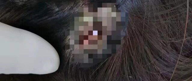 校长被曝与女家长婚外情，女方实名举报称被对方妻子砸伤