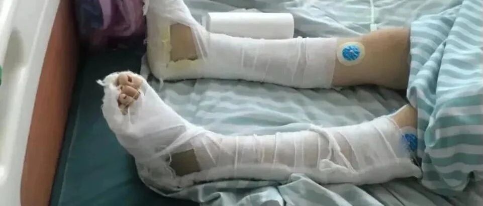 女子不堪家暴跳楼一年后仍无法离婚，事发后还遭公公死亡威胁