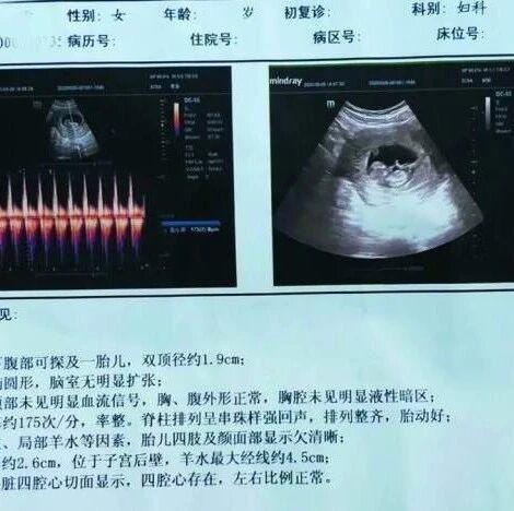 精神病患者在医院封闭治疗3个月后怀孕，院方回应